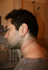 Injuries sustained by Jared